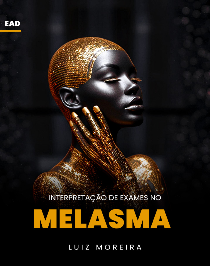 Interpretação de exames no melasma